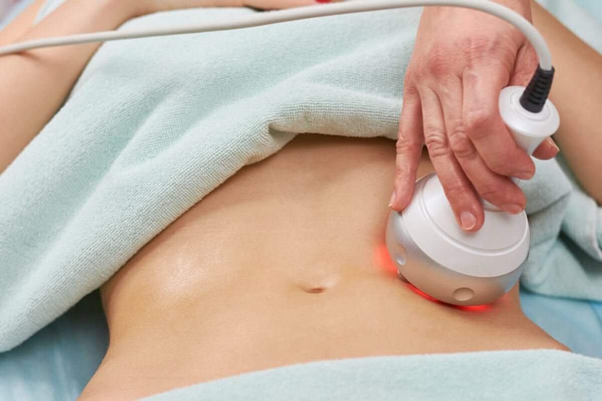 Facts On Laser Lipo